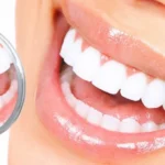 tandblegning-hvordan-man-forbereder-et-naturligt-og-harmloest-naturmiddel.webp.webp